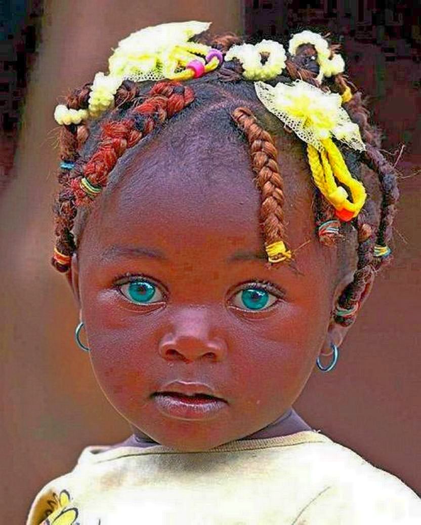 Губы негроидной расы. Девочка с необычными глазами. Африканцы с синими глазами. Необычный цвет глаз. Африканские девушки с голубыми глазами.